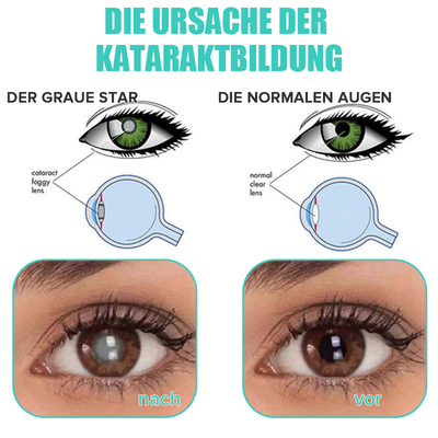 KlarTropfen™ Rötung Schnell Lindern