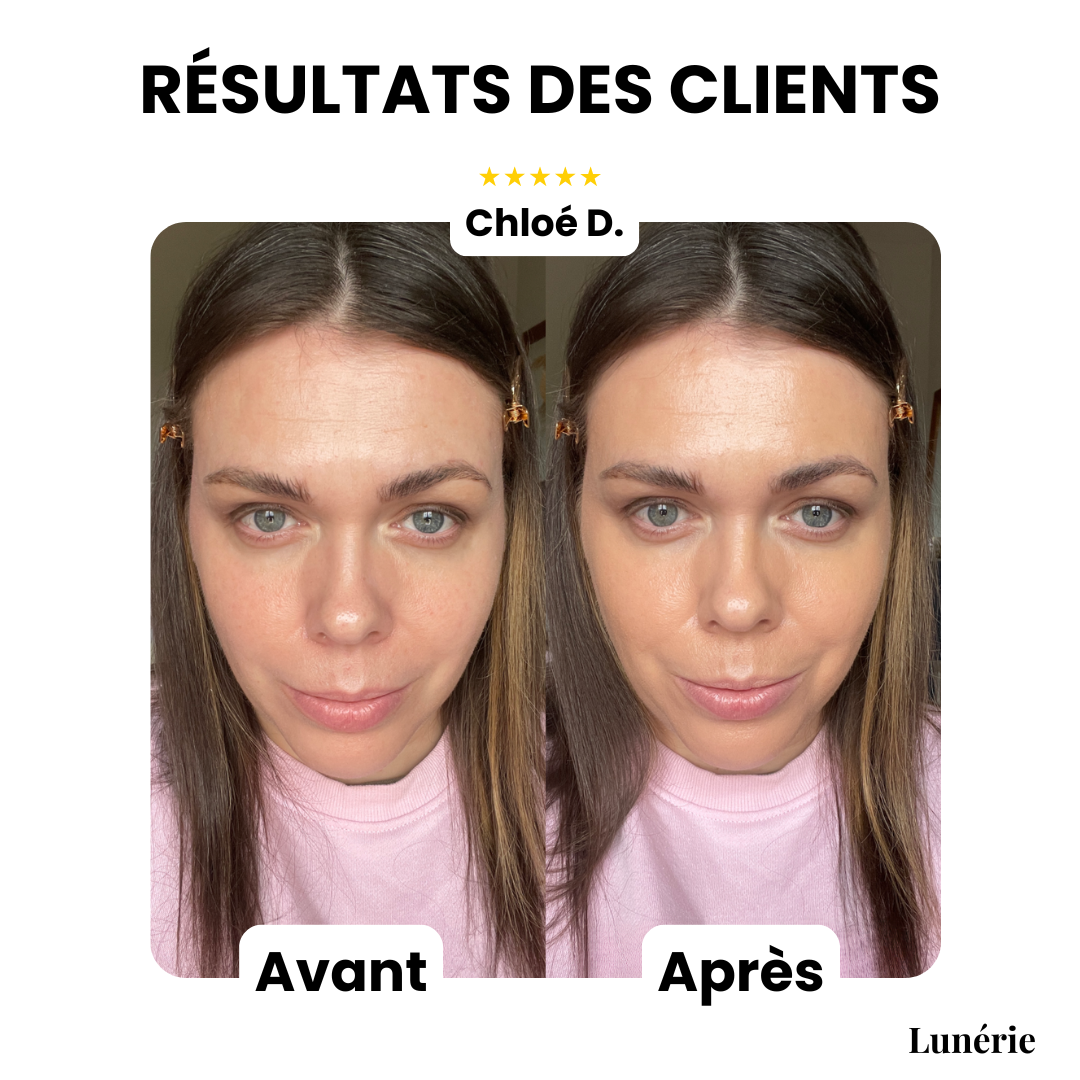 StrahlTeint™ Ebenmäßige Teint-Abdeckung